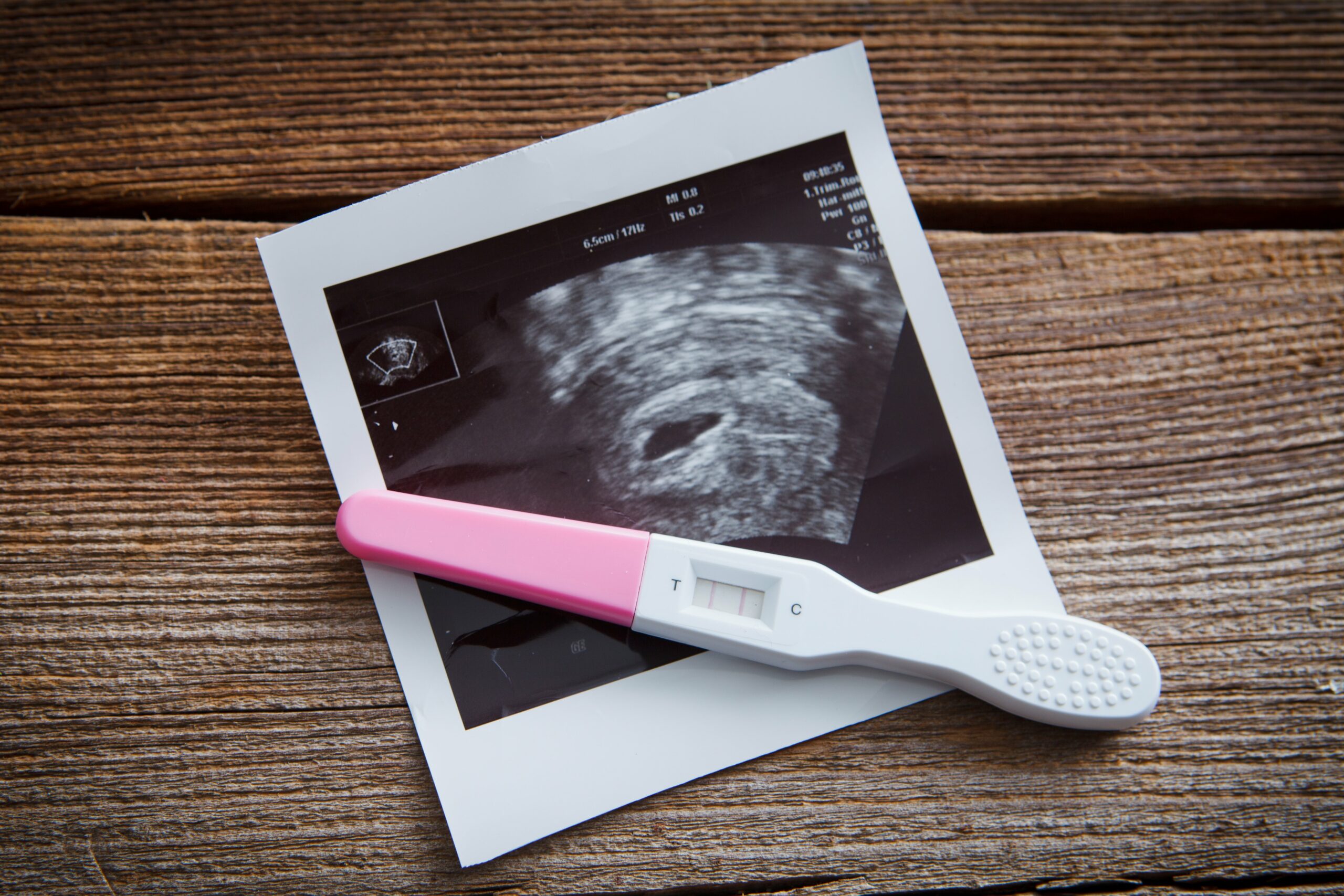 Schwangerschaftstest und Ultraschallbild