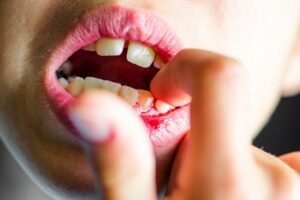 Kind packt in den Mund, in dem ein Zahn blutet