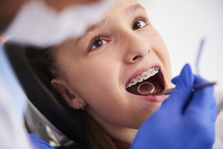 Zahnzusatzversicherung für Kinder: Sinnvoll oder nicht?